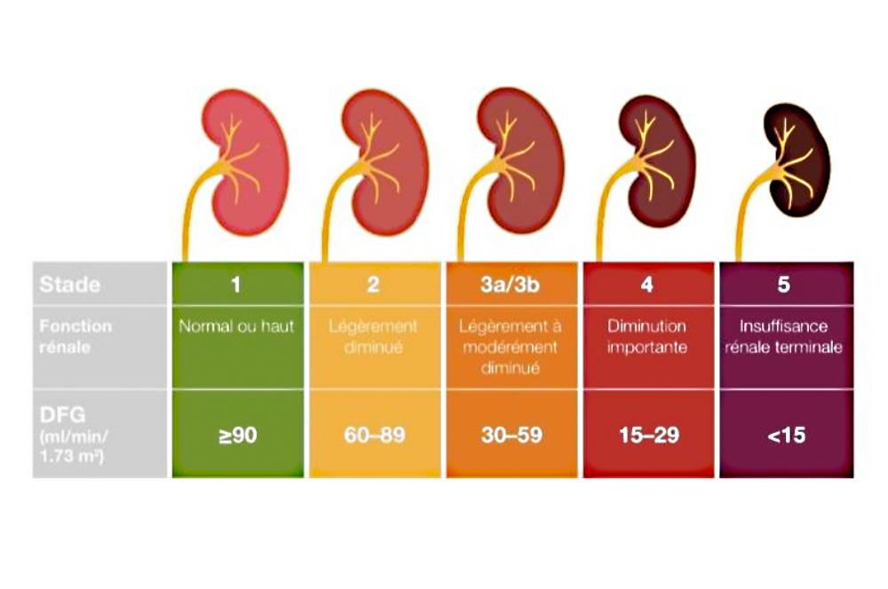 Informations Patient N phrologues Mermoz Informations Patient N phrologues Mermoz